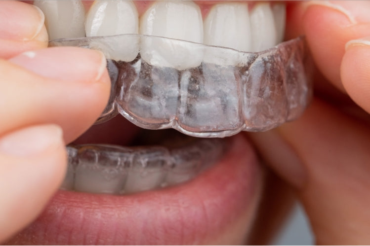 clear aligners after cleaning it