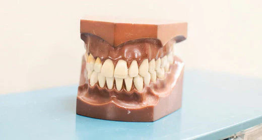 Un primer plano de un modelo dental que muestra un conjunto de dientes rectos.