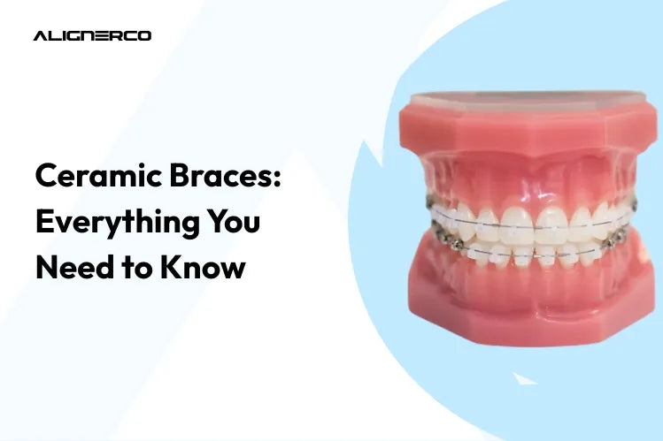 Brackets de cerámica sobre un modelo de dientes