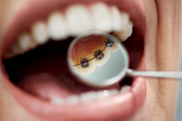 Una mujer sonriente con clase muerdo.