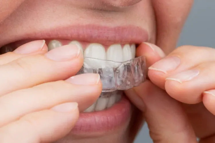 Una niña aplicando alineadores transparentes para enderezar los dientes en casa.
