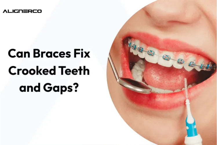 Una niña que usa aparatos metálicos de colores para enderezar los dientes.