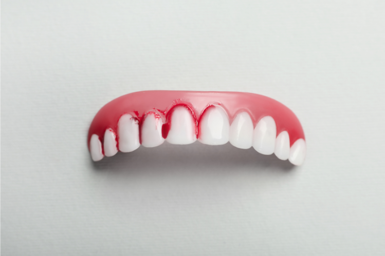 Remedios caseros para la gingivitis: Formas naturales de curar sus encías