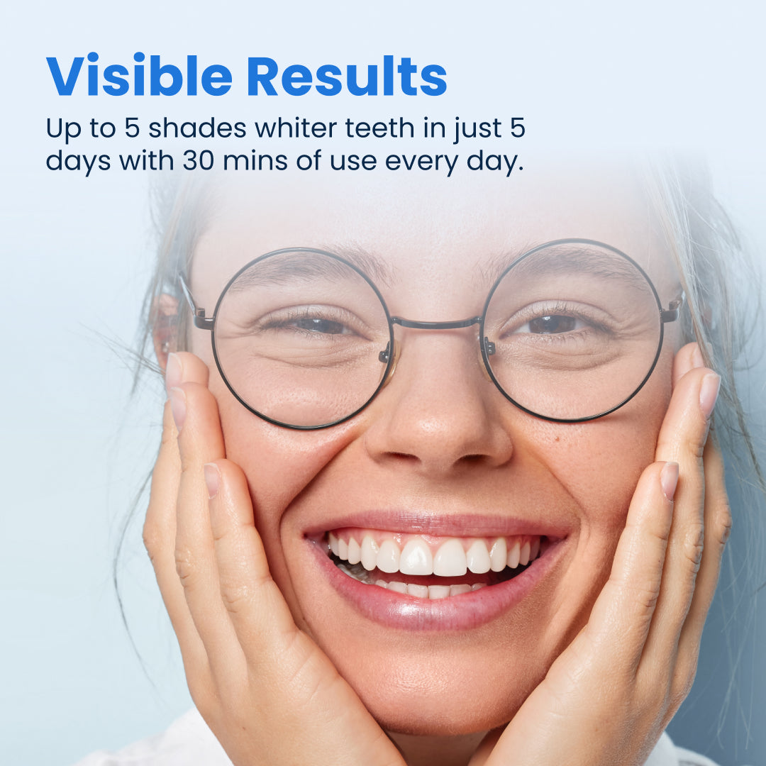 Kit de blanqueamiento dental 