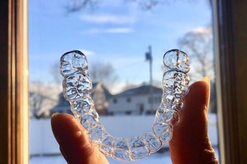 Plan de Protección de Sonrisa