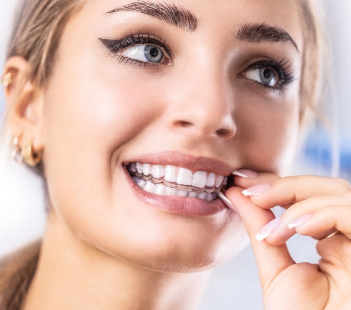 Ventaja de la sonrisa