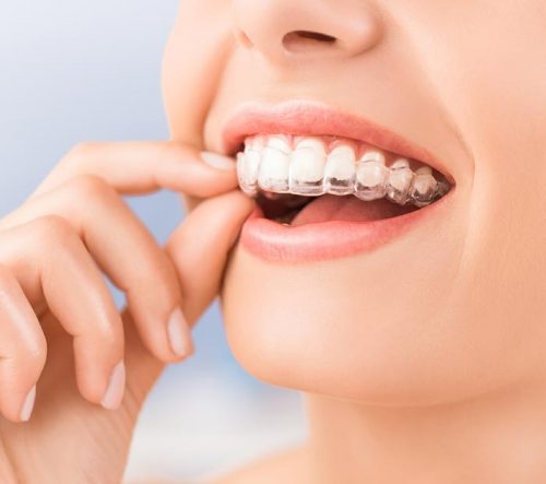 Ventaja Nocturna Plus