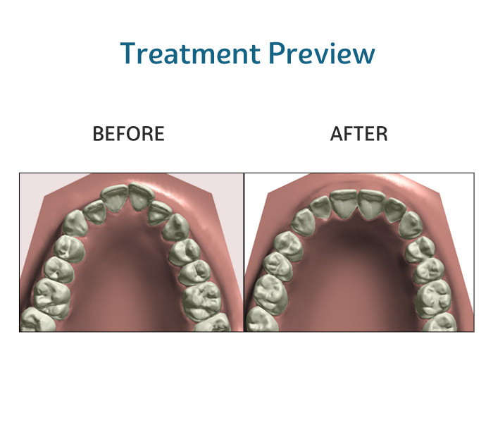 Ventaja Nocturna Plus